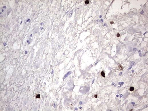 CEA (CEACAM5) Antibody in Immunohistochemistry (Paraffin) (IHC (P))