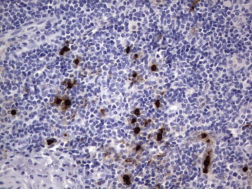 CEA (CEACAM5) Antibody in Immunohistochemistry (Paraffin) (IHC (P))