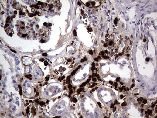 CEA (CEACAM5) Antibody in Immunohistochemistry (Paraffin) (IHC (P))