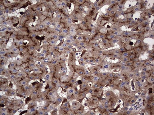 CEA (CEACAM5) Antibody in Immunohistochemistry (Paraffin) (IHC (P))