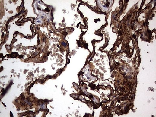 CEA (CEACAM5) Antibody in Immunohistochemistry (Paraffin) (IHC (P))