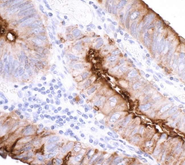 CEACAM1 Antibody in Immunocytochemistry (ICC/IF)