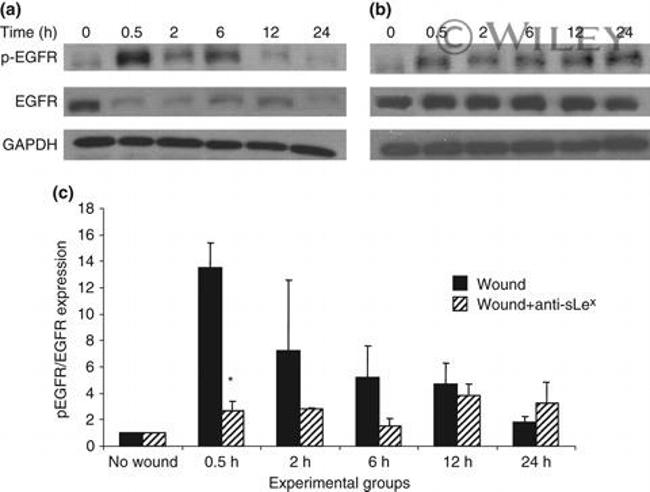 Phospho-EGFR (Tyr845) Antibody in Western Blot (WB)