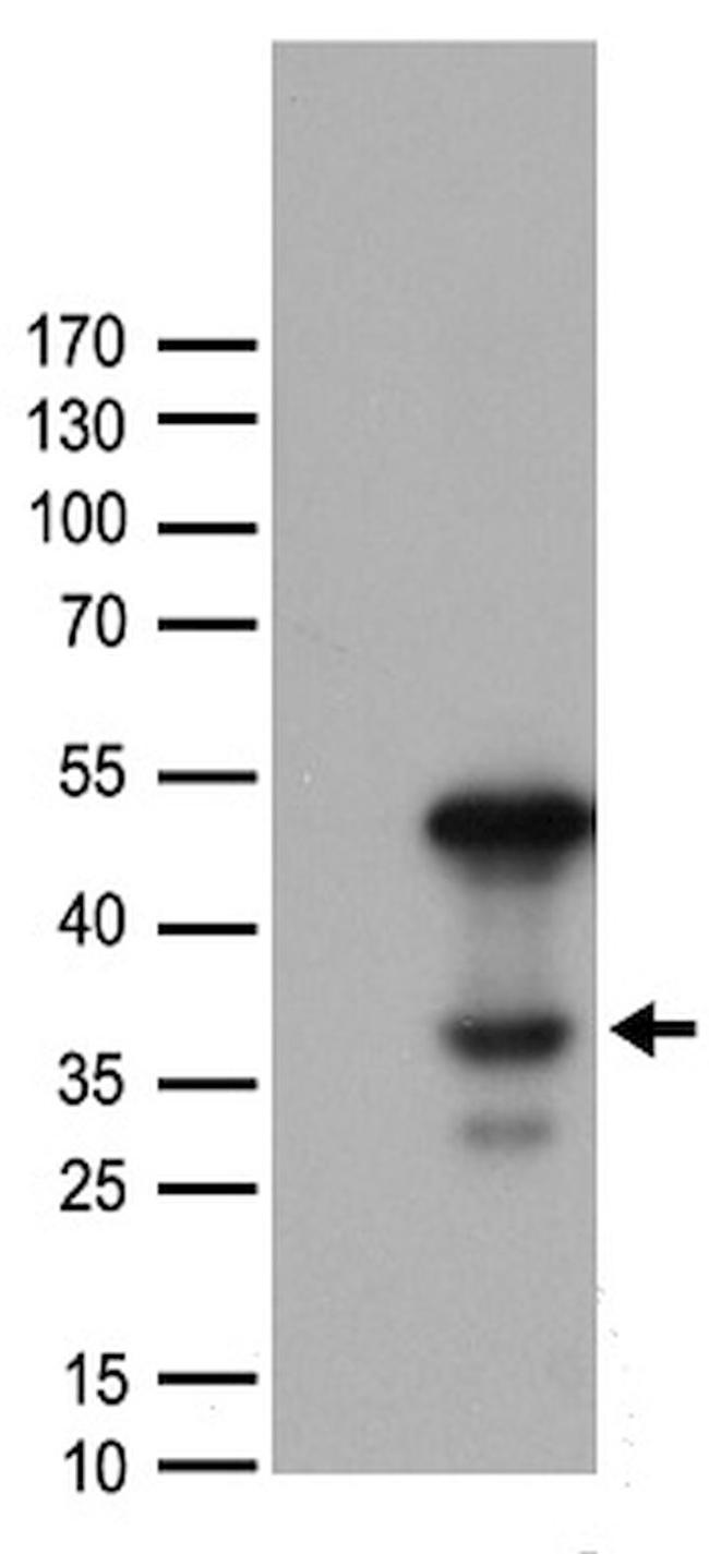 CEBPA Antibody in Western Blot (WB)