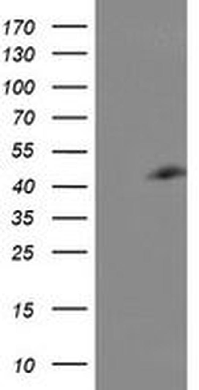 CENPH Antibody in Western Blot (WB)