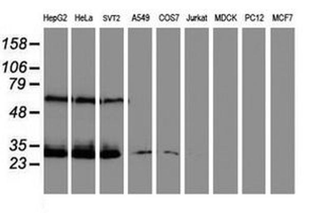 CENPH Antibody in Western Blot (WB)