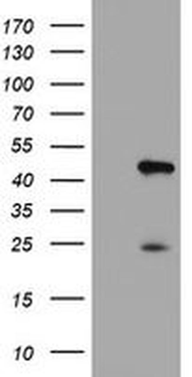 CENPH Antibody in Western Blot (WB)