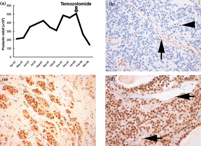 MGMT Antibody in Immunohistochemistry (Paraffin) (IHC (P))