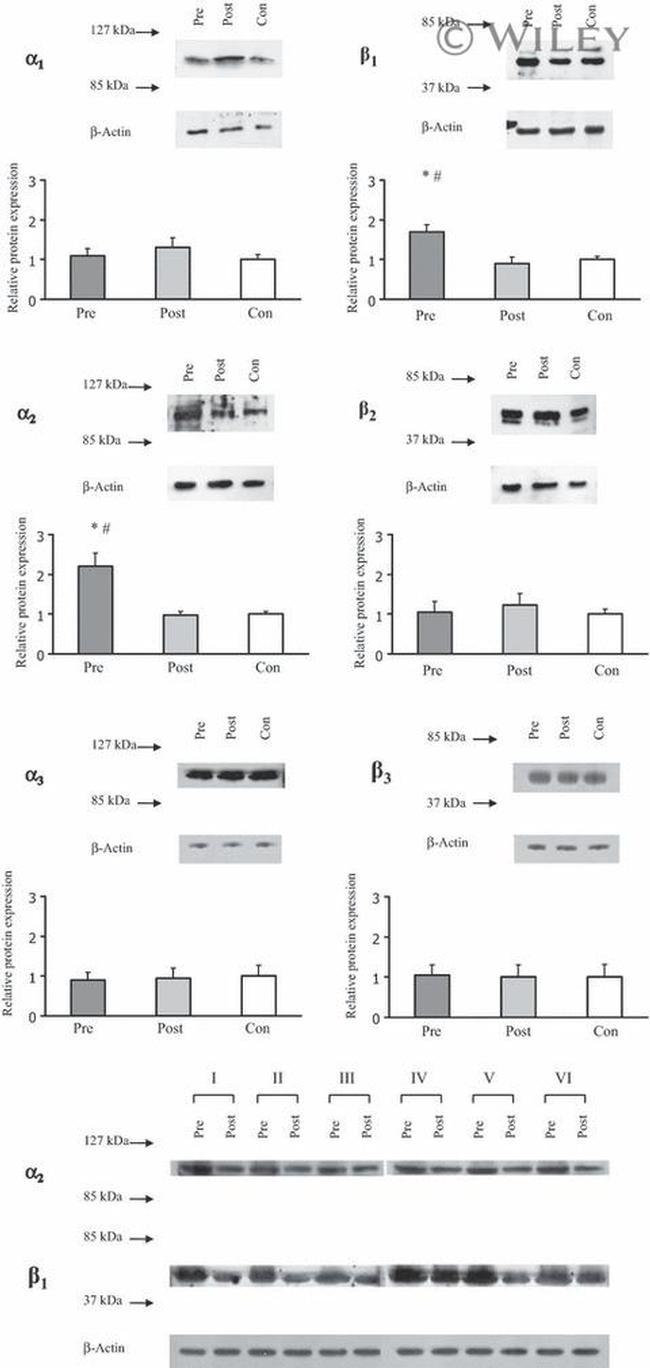 ATP1A3 Antibody in Western Blot (WB)