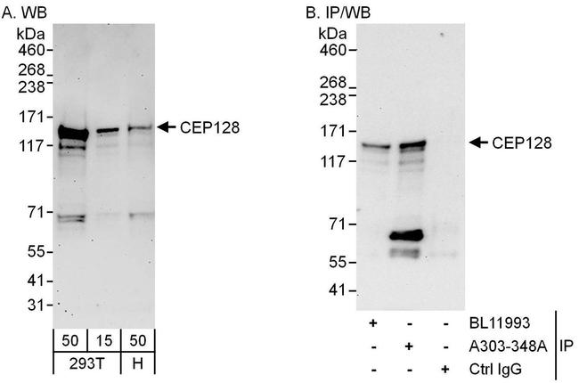 CEP128 Antibody in Western Blot (WB)