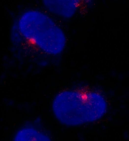 CEP290 Antibody in Immunocytochemistry (ICC/IF)