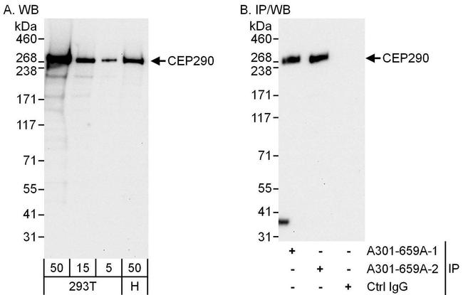 CEP290 Antibody in Western Blot (WB)