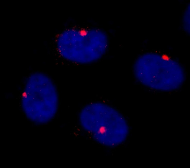 CEP290 Antibody in Immunocytochemistry (ICC/IF)