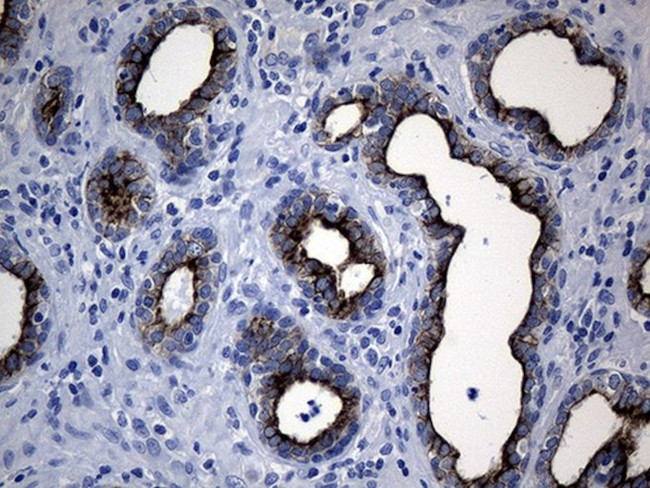 CEP63 Antibody in Immunohistochemistry (Paraffin) (IHC (P))