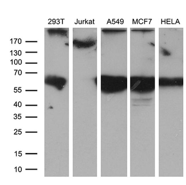 CEP63 Antibody in Western Blot (WB)