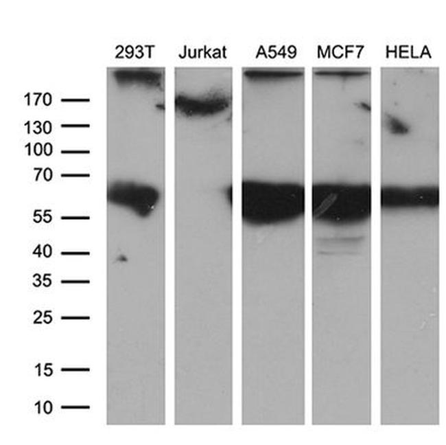 CEP63 Antibody in Western Blot (WB)