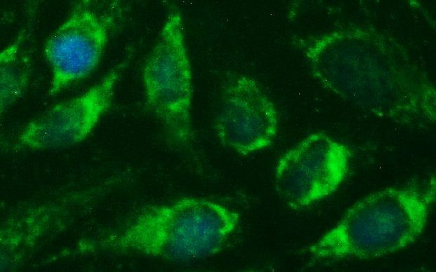 CEP68 Antibody in Immunocytochemistry (ICC/IF)