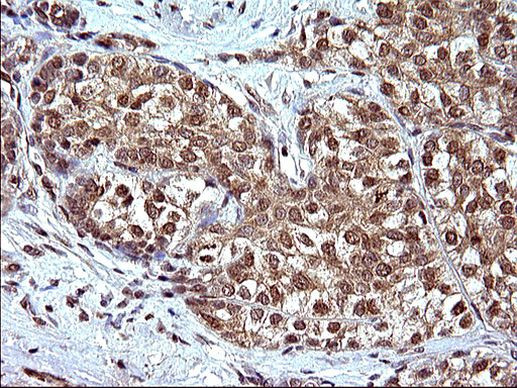 CEP68 Antibody in Immunohistochemistry (Paraffin) (IHC (P))