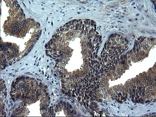 CEP68 Antibody in Immunohistochemistry (Paraffin) (IHC (P))