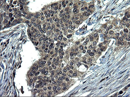 CEP68 Antibody in Immunohistochemistry (Paraffin) (IHC (P))