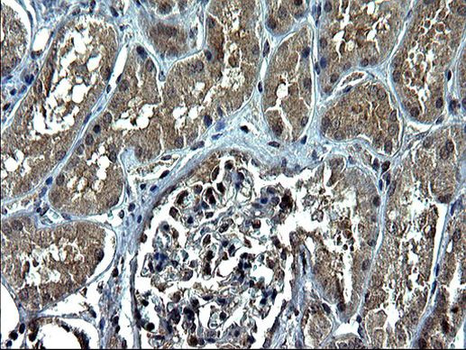 CEP68 Antibody in Immunohistochemistry (Paraffin) (IHC (P))