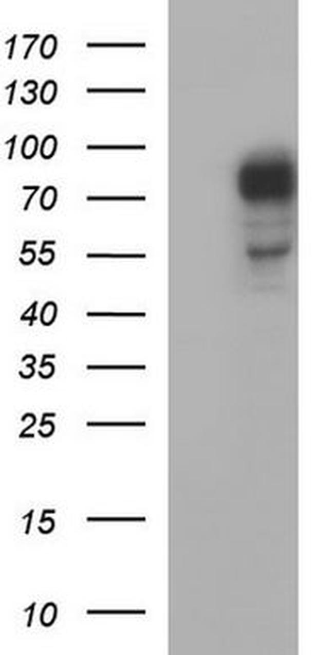 CEP68 Antibody in Western Blot (WB)