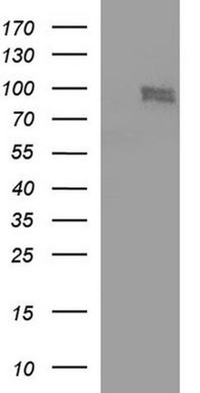 CEP68 Antibody in Western Blot (WB)