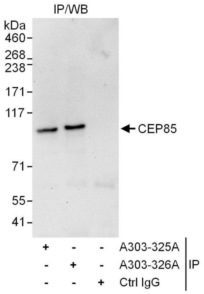 CEP85 Antibody in Immunoprecipitation (IP)