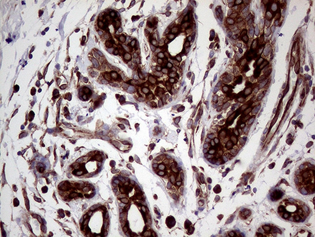 CERS2 Antibody in Immunohistochemistry (Paraffin) (IHC (P))