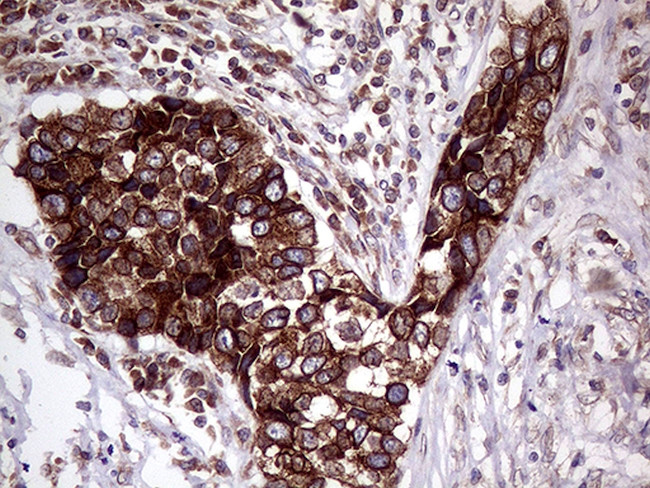 CERS2 Antibody in Immunohistochemistry (Paraffin) (IHC (P))