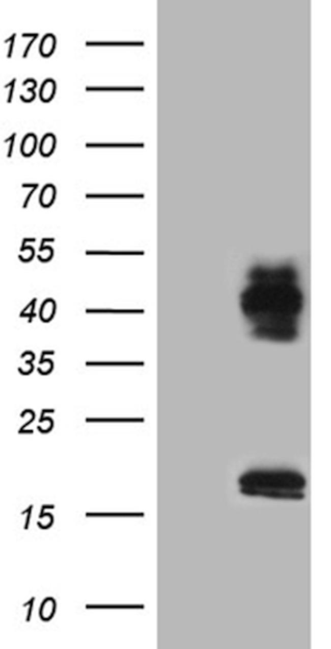 CERS2 Antibody in Western Blot (WB)