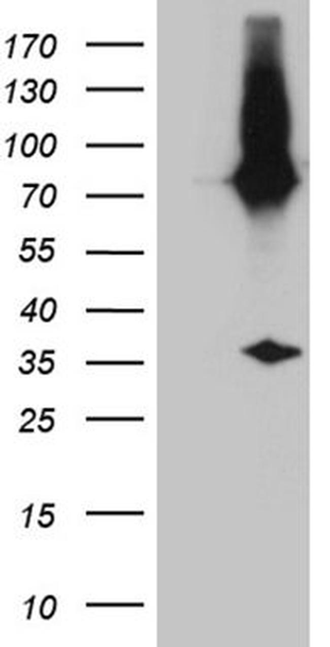 E2-Crimson Antibody in Western Blot (WB)