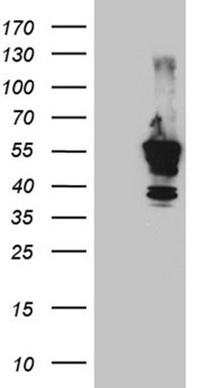 tdTomato Antibody in Western Blot (WB)