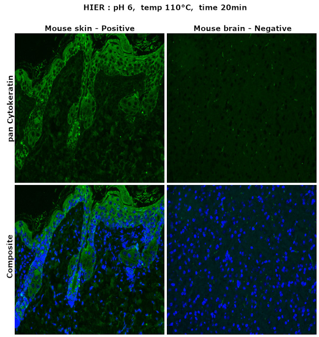 pan Cytokeratin (pan CK) Antibody