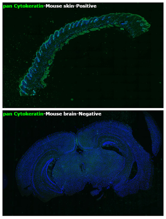 pan Cytokeratin (pan CK) Antibody