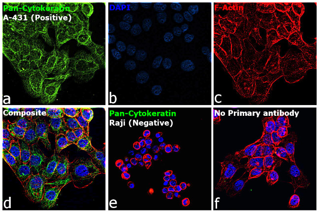 pan Cytokeratin (pan CK) Antibody