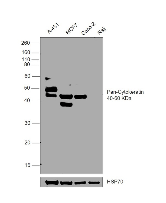 pan Cytokeratin (pan CK) Antibody in Western Blot (WB)