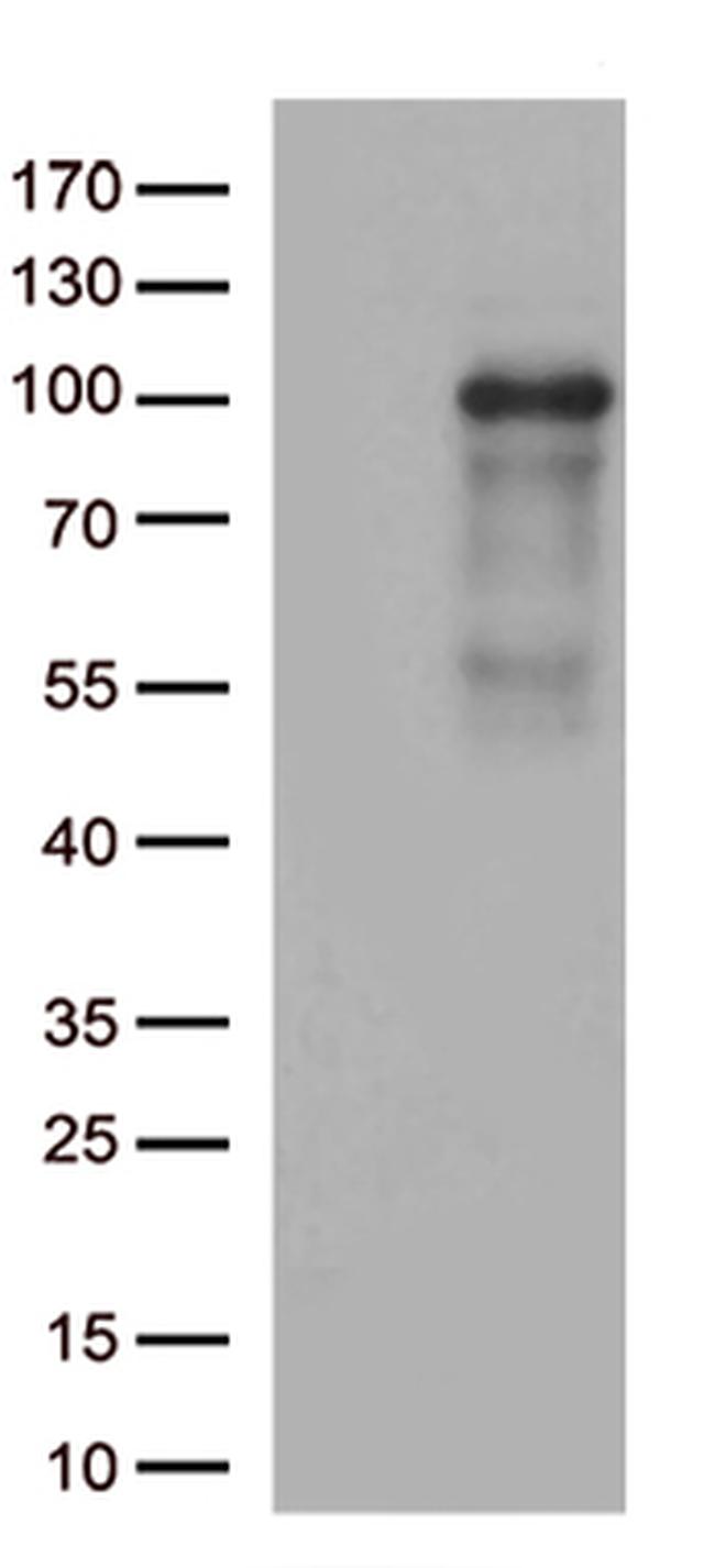 ADAM28 Antibody in Western Blot (WB)