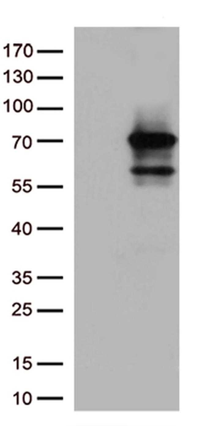 MSF (SEPT9) Antibody in Western Blot (WB)