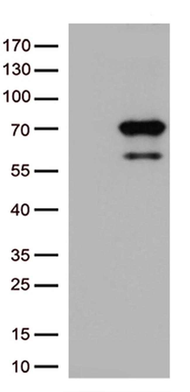 MSF (SEPT9) Antibody in Western Blot (WB)