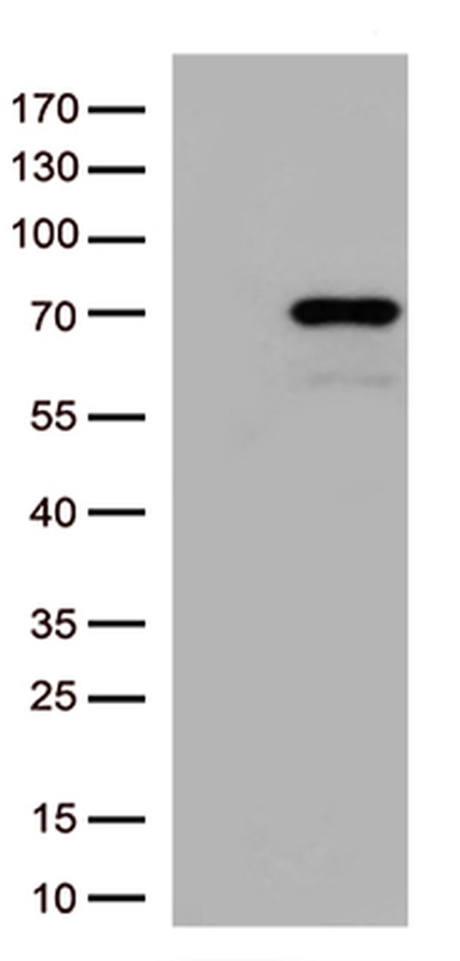 MSF (SEPT9) Antibody in Western Blot (WB)