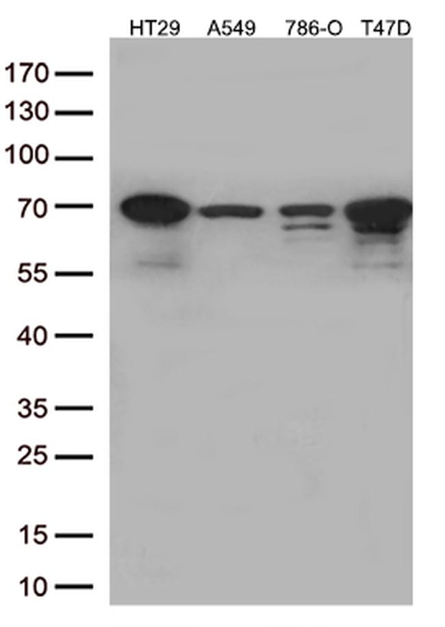 MSF (SEPT9) Antibody in Western Blot (WB)