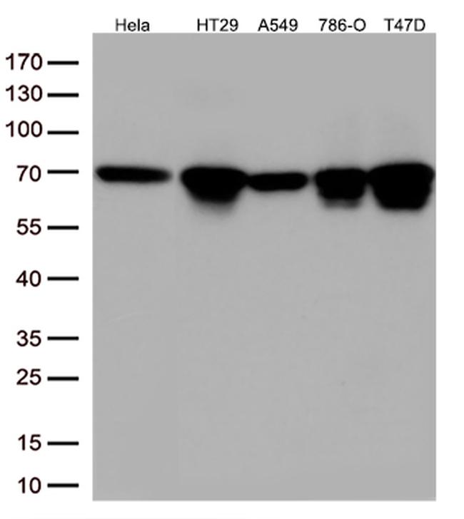 MSF (SEPT9) Antibody in Western Blot (WB)