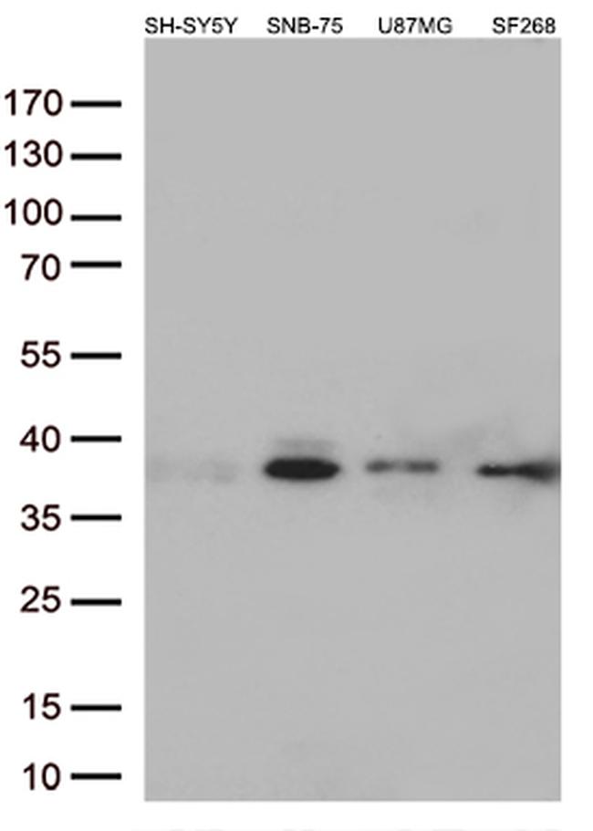 Syntaxin 1a (STX1A) Antibody in Western Blot (WB)