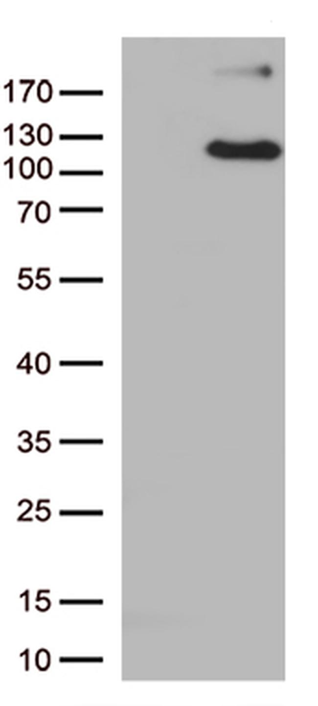 ARTS1 (ERAP1) Antibody in Western Blot (WB)