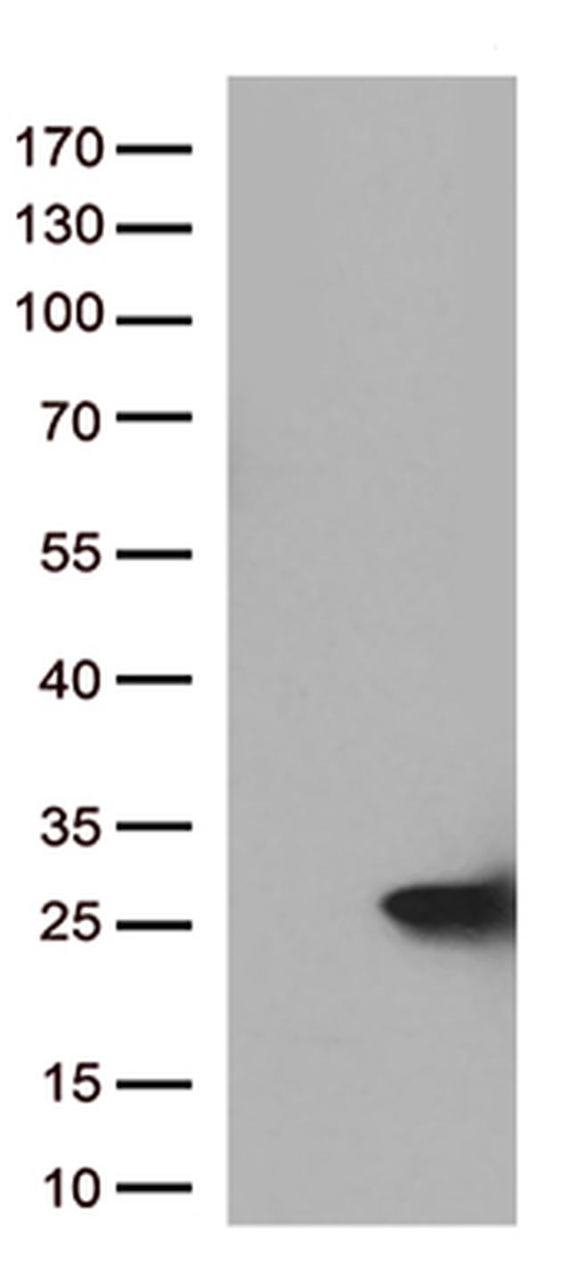 Cytoglobin (CYGB) Antibody in Western Blot (WB)