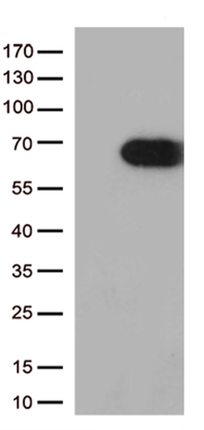 USH1C Antibody in Western Blot (WB)