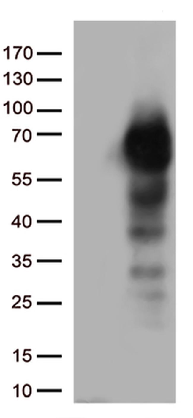 p75 NGF Receptor (NGFR) Antibody in Western Blot (WB)