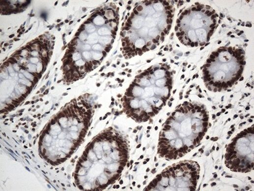 EWSR1 Antibody in Immunohistochemistry (Paraffin) (IHC (P))