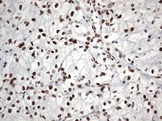 EWSR1 Antibody in Immunohistochemistry (Paraffin) (IHC (P))